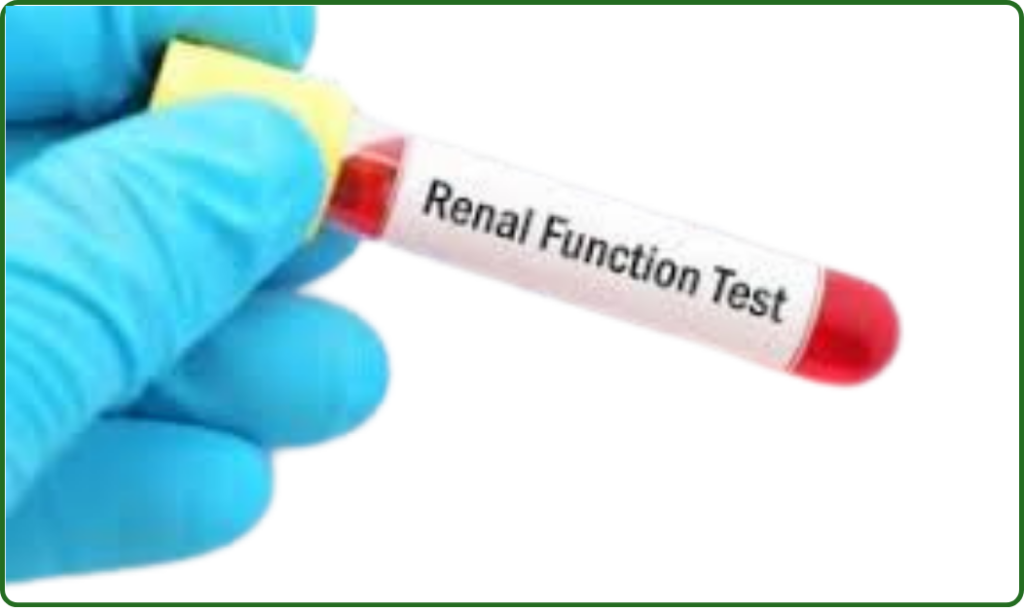 Kidney Function Test at home Dubai