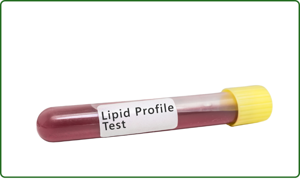 Lipid Profile Test at home dubai