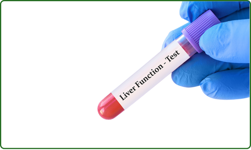Liver Function Test at home Dubai